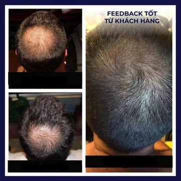Before and after hair growth feedback from a customer showing results after 1 week, 3 weeks, and 1 month.