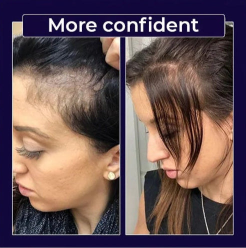 Advertisement showing before and after images of hair health with text on product effectiveness.