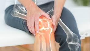 Joint Pain & Mobility Issues