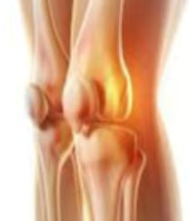 Worn-out Cartilage