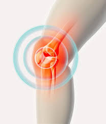 Joint Inflammation & Swelling