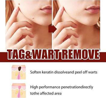 Tags & Moles Remover